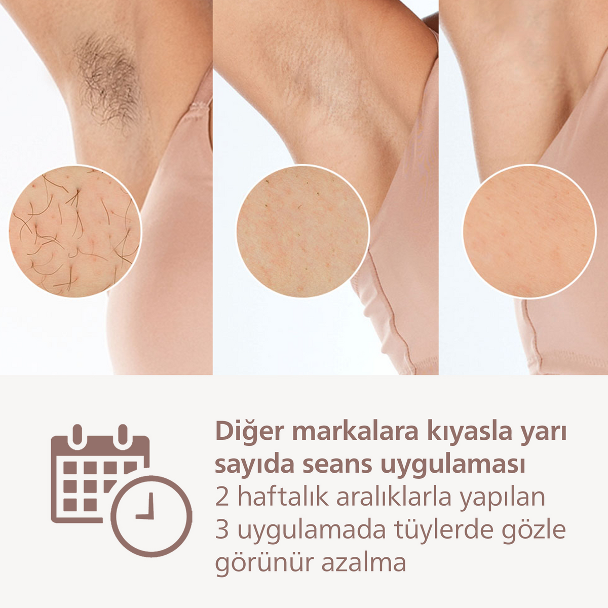 PHILIPS Lumea 9900 Serisi BRI953/01 IPL Tüy Alma, SkinAI Uygulama, Vücut, Yüz ve Bikini, 3 Başlık, Çanta